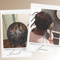 Avant après Kaylabé montrant l’évolution de la densité sur cheveux crépus